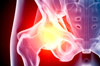 mom_hip_implants.jpg